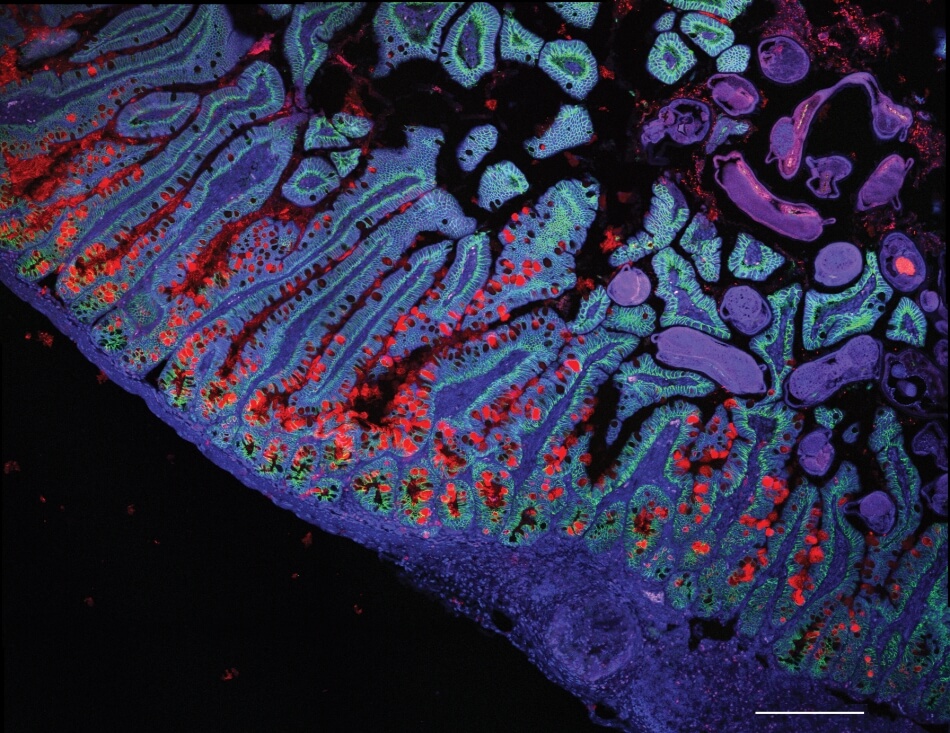 Scientists affiliated with the Human Cell Atlas are working to understand the human  small intestine—both its healthy functions and in disease states such as Crohn’s Disease.  © Grace Burgin, Noga Rogel, and Moshe Biton, Klarman Cell Observatory, Broad Institute.  Dr. Moshe Biton is now affiliated with the Weizmann Institute of Science, Israel. 