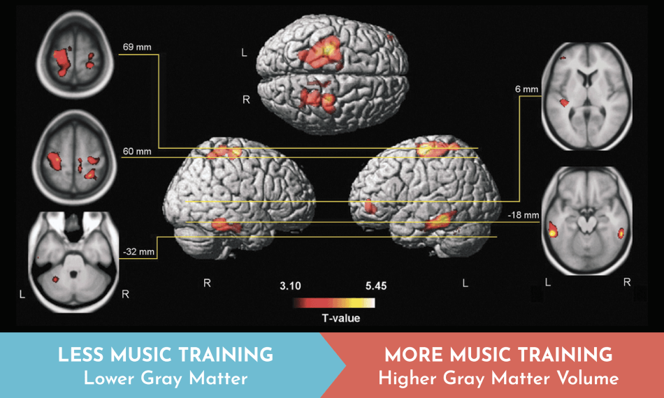 The Brain on Music