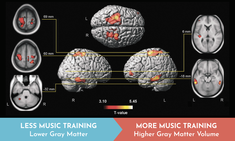 brain-on-music.png The Brain on Music