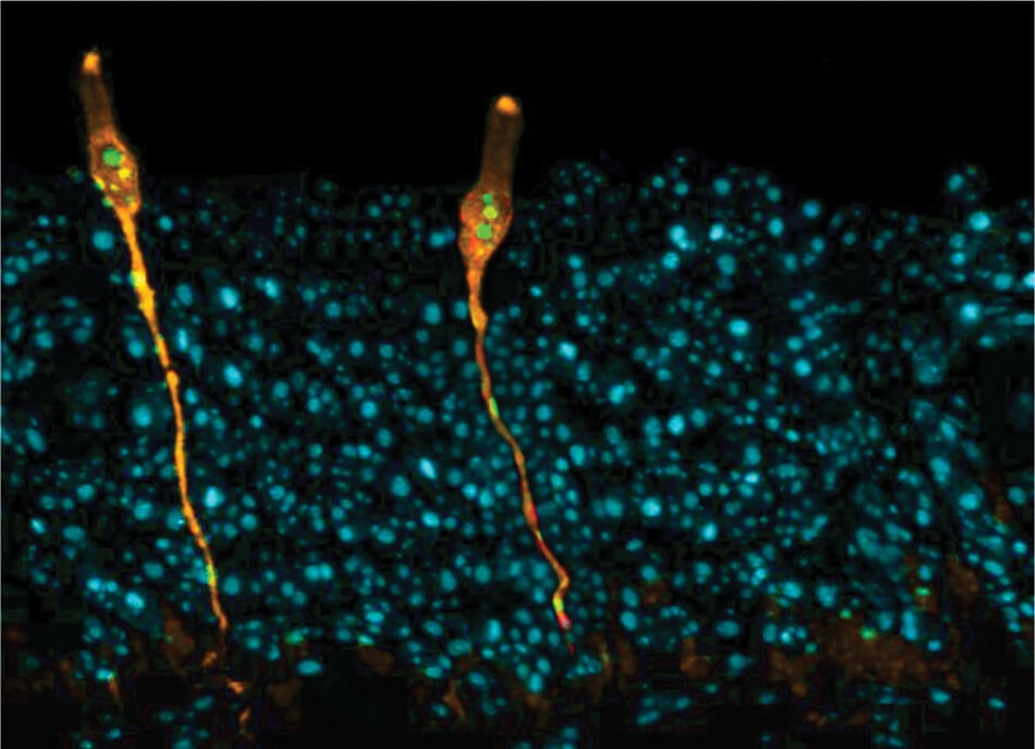 New Human Cell Type Identified in Respiratory Tract New Human Cell Type Identified in Respiratory Tract