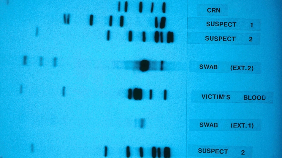 DNA sequencing gel