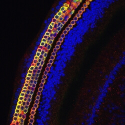 The receptor for auditory stimuli, the organ of Corti