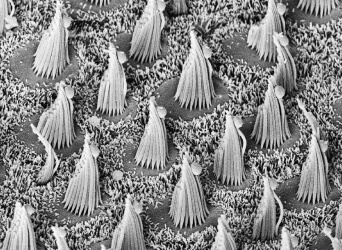 electron micrograph of inner ear