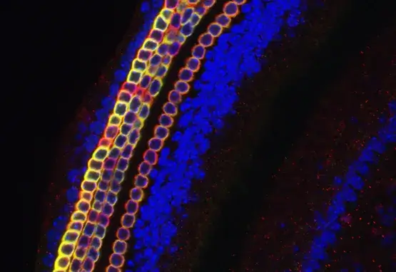 The receptor for auditory stimuli, the organ of Corti