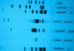 DNA sequencing gel