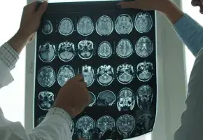 Photograph with a panel of brain scans held up. 
