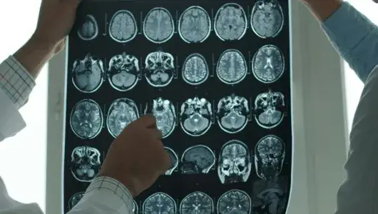 Photograph with a panel of brain scans held up. 